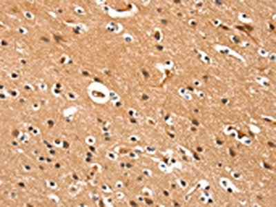 The image on the left is immunohistochemistry of paraffin-embedded Human brain  tissue using DDAH2 Antibody(DDAH2 Antibody) at dilution 1/15, on the right is treated with synthetic peptide. (Original magnification: ×200)Rabbit anti-Human DDAH2 Polyclonal Antibody