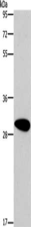 Gel: 10%SDS-PAGE, Lysate: 40 μg, Lane: Human fetal brain tissue, Primary antibody: DDAH2 Antibody(DDAH2 Antibody) at dilution 1/300, Secondary antibody: Goat anti rabbit IgG at 1/8000 dilution, Exposure time: 30 secondsRabbit anti-Human DDAH2 Polyclonal Antibody