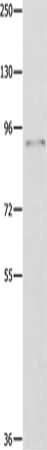 Gel: 8%SDS-PAGE, Lysate: 40 μg, Lane: Hela cells, Primary antibody: ABCB9 Antibody(ABCB9 Antibody) at dilution 1/250, Secondary antibody: Goat anti rabbit IgG at 1/8000 dilution, Exposure time: 1 minute