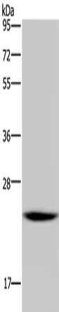 Gel: 10%SDS-PAGE, Lysate: 30 μg, Lane: HT29 cells, Primary antibody: AK1 Antibody(AK1 Antibody) at dilution 1/400, Secondary antibody: Goat anti rabbit IgG at 1/8000 dilution, Exposure time: 2minRabbit anti-Human AK1 Polyclonal Antibody