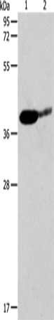 Gel: 12%SDS-PAGE, Lysate: 40 μg, Lane 1-2: Mouse brain tissue, human liver cancer tissue, Primary antibody: SIRT3 Antibody(SIRT3 Antibody) at dilution 1/500, Secondary antibody: Goat anti rabbit IgG at 1/8000 dilution, Exposure time: 90 secondsRabbit anti-Human SIRT3 Polyclonal Antibody