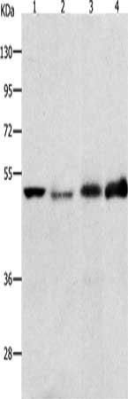 Gel: 10%SDS-PAGE, Lysate: 40 μg, Lane 1-4: Hela cells, human fetal lung tissue, human intestines tissue, human lung tissue, Primary antibody: EDNRB Antibody(EDNRB Antibody) at dilution 1/500, Secondary antibody: Goat anti rabbit IgG at 1/8000 dilution, Exposure time: 1 hourRabbit anti-Human EDNRB Polyclonal Antibody