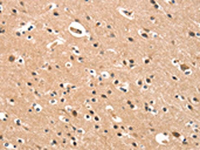 The image on the left is immunohistochemistry of paraffin-embedded Human brain tissue using the antibody Antibody) at dilution 1/15, on the right is treated with synthetic peptide. (Original magnification: ×200)