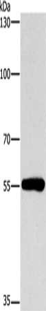 Gel: 8%SDS-PAGE, Lysate: 40 μg, Lane: Human lymphoma tissue, Primary antibody: CYP46A1 Antibody(CYP46A1 Antibody) at dilution 1/200, Secondary antibody: Goat anti rabbit IgG at 1/8000 dilution, Exposure time: 1 minute