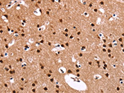 The image on the left is immunohistochemistry of paraffin-embedded Human brain  tissue using RPSA Antibody(RPSA Antibody) at dilution 1/60, on the right is treated with fusion protein. (Original magnification: ×200)Rabbit anti-Human RPSA Polyclonal Antibody