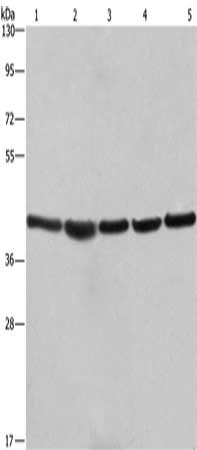 Gel: 10%SDS-PAGE, Lysate: 40 μg, Lane 1-5: A549 cells, NIH/3T3 cells, 293T cells, human hepatocellular carcinoma tissue, hela cells, Primary antibody: RPSA Antibody(RPSA Antibody) at dilution 1/433.3, Secondary antibody: Goat anti rabbit IgG at 1/8000 dilution, Exposure time: 15 secondsRabbit anti-Human RPSA Polyclonal Antibody