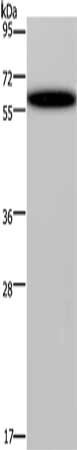 Gel: 8%SDS-PAGE, Lysate: 40 μg, Lane: Hela cells, Primary antibody: DDX19B Antibody(DDX19B Antibody) at dilution 1/400, Secondary antibody: Goat anti rabbit IgG at 1/8000 dilution, Exposure time: 40 secondsRabbit anti-Human DDX19B Polyclonal Antibody