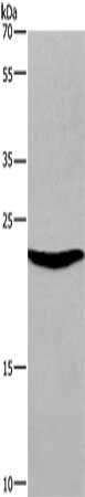 Gel: 8%SDS-PAGE, Lysate: 40 μg, Lane: Mouse heart tissue, Primary antibody: SOCS3 Antibody(SOCS3 Antibody) at dilution 1/300, Secondary antibody: Goat anti rabbit IgG at 1/8000 dilution, Exposure time: 20 secondsRabbit anti-Human SOCS3 Polyclonal Antibody