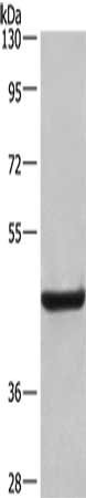 Gel: 10%SDS-PAGE, Lysate: 40 μg, Lane: Human placenta tissue, Primary antibody: LAMP2 Antibody(LAMP2 Antibody) at dilution 1/500, Secondary antibody: Goat anti rabbit IgG at 1/8000 dilution, Exposure time: 30 seconds