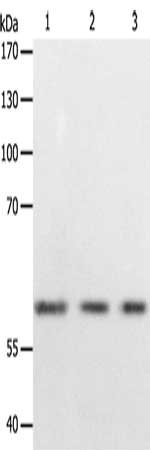 Gel: 10%SDS-PAGE, Lysate: 50 μg, Lane 1-3: 293T cells, Hela cells, Jurkat cells, Primary antibody: PSMD3 Antibody(PSMD3 Antibody) at dilution 1/400, Secondary antibody: Goat anti rabbit IgG at 1/8000 dilution, Exposure time: 30 seconds