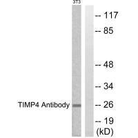 Western blot analysis of extracts from NIH/3T3 cells, using TIMP4 antibody.