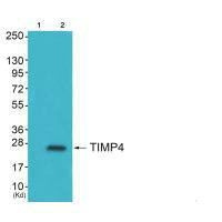 Western blot analysis of extracts from HepG2 cells (Lane 2), using TIMP4 antiobdy. The lane on the left is treated with synthesized peptide.
