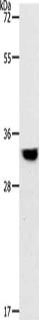 Gel: 10%SDS-PAGE, Lysate: 40 μg, Lane: Human fetal muscle tissue, Primary antibody: TPM2 Antibody(TPM2 Antibody) at dilution 1/400, Secondary antibody: Goat anti rabbit IgG at 1/8000 dilution, Exposure time: 2 minutesRabbit anti-Human TPM2 Polyclonal Antibody