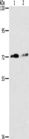 Gel: 6%SDS-PAGE, Lysate: 40 μg, Lane 1-2: PC3 cells, K562 cells, Primary antibody: ITGB7 Antibody(ITGB7 Antibody) at dilution 1/200, Secondary antibody: Goat anti rabbit IgG at 1/8000 dilution, Exposure time: 10 minutes