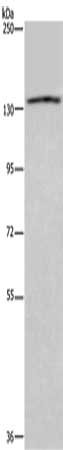 Gel: 6%SDS-PAGE, Lysate: 40 μg, Lane: LoVo cells, Primary antibody: ITGAE Antibody(ITGAE Antibody) at dilution 1/550, Secondary antibody: Goat anti rabbit IgG at 1/8000 dilution, Exposure time: 3 minutes