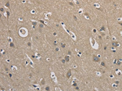 The image on the left is immunohistochemistry of paraffin-embedded Human brain tissue using EMC8 Antibody(EMC8 Antibody) at dilution 1/30, on the right is treated with fusion protein. (Original magnification: ×200)Rabbit anti-Human EMC8 Polyclonal Antibody