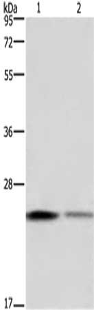 Gel: 10%SDS-PAGE,Lysate: 40 μg,Lane 1-2: Hela cells, HT-29 cells,Primary antibody: EMC8 Antibody(EMC8 Antibody) at dilution 1/650 dilution,Secondary antibody: Goat anti rabbit IgG at 1/8000 dilution,Exposure time: 1 minuteRabbit anti-Human EMC8 Polyclonal Antibody