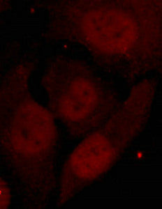 Immunofluorescence staining of methanol-fixed Hela cells showing nuclear staining using HDAC2(Phospho-Ser394) Antibody.Rabbit anti-Human HDAC2 Polyclonal Antibody