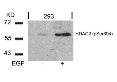 Western blot analysis of extracts from 293 cells untreated or treated with EGF using HDAC2(Phospho-Ser394) Antibody.Rabbit anti-Human HDAC2 Polyclonal Antibody