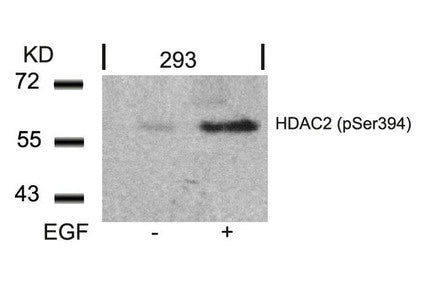 Western blot analysis of extracts from 293 cells untreated or treated with EGF using HDAC2(Phospho-Ser394) Antibody.Rabbit anti-Human HDAC2 Polyclonal Antibody