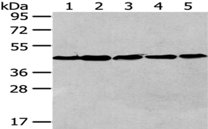 Gel: 8%SDS-PAGE,Lysate: 40 μg,Lane 1-5: Human liver cancer tissue, 293T cells, A172 cells, Hela cells, MCF7 cells,Primary antibody: VPS4A Antibody(VPS4A Antibody) at dilution 1/200 dilution,Secondary antibody: Goat anti rabbit IgG at 1/8000 dilution,Exposure time: 1 minuteRabbit anti-Human VPS4A Polyclonal Antibody
