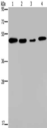 Gel: 8%SDS-PAGE, Lysate: 40 μg, Lane 1-4: A549 cells, Hela cells, HepG2 cells, 293T cells, Primary antibody: PHKG2 Antibody(PHKG2 Antibody) at dilution 1/200, Secondary antibody: Goat anti rabbit IgG at 1/8000 dilution, Exposure time: 1 minuteRabbit anti-Human PHKG2 Polyclonal Antibody
