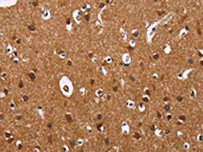 The image on the left is immunohistochemistry of paraffin-embedded Human brain  tissue using ILK Antibody(ILK Antibody) at dilution 1/60, on the right is treated with fusion protein. (Original magnification: ×200)Rabbit anti-Human ILK Polyclonal Antibody