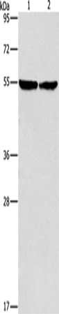 Gel: 8%SDS-PAGE, Lysate: 40 μg, Lane 1-2: Mouse heart tissue, hela cells, Primary antibody: ILK Antibody(ILK Antibody) at dilution 1/600, Secondary antibody: Goat anti rabbit IgG at 1/8000 dilution, Exposure time: 40 secondsRabbit anti-Human ILK Polyclonal Antibody