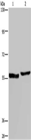 Gel: 6%SDS-PAGE, Lysate: 40 μg, Lane 1-2: Human testis tissue, A375 cells, Primary antibody: SLC1A6 Antibody(SLC1A6 Antibody) at dilution 1/400, Secondary antibody: Goat anti rabbit IgG at 1/8000 dilution, Exposure time: 10 secondsRabbit anti-Human SLC1A6 Polyclonal Antibody