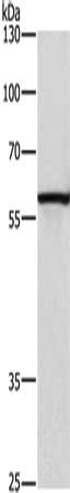 Gel: 8%SDS-PAGE, Lysate: 40 μg, Lane: Hela cells, Primary antibody: CAT Antibody(CAT Antibody) at dilution 1/300, Secondary antibody: Goat anti rabbit IgG at 1/8000 dilution, Exposure time: 3 minutes