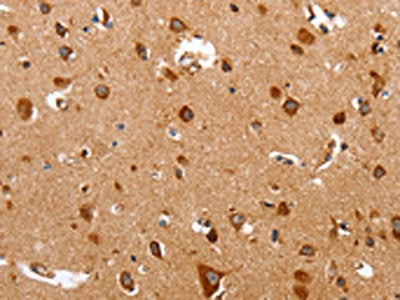 The image on the left is immunohistochemistry of paraffin-embedded Human brain tissue using TRAP1 Antibody(TRAP1 Antibody) at dilution 1/60, on the right is treated with fusion protein. (Original magnification: ×200)Rabbit anti-Human TRAP1 Polyclonal Antibody