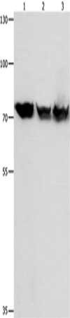 Gel: 10%SDS-PAGE, Lysate: 30 μg, Lane 1-3: K562 cells, Jurkat cells, 293T cells, Primary antibody: TRAP1 Antibody(TRAP1 Antibody) at dilution 1/1050, Secondary antibody: Goat anti rabbit IgG at 1/8000 dilution, Exposure time: 1 minuteRabbit anti-Human TRAP1 Polyclonal Antibody