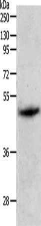 Gel: 10%SDS-PAGE, Lysate: 60 μg, Lane: Human liver cancer tissue, Primary antibody: PGA3/PGA4/PGA5 Antibody(PGA3/PGA4/PGA5 Antibody) at dilution 1/1000, Secondary antibody: Goat anti rabbit IgG at 1/8000 dilution, Exposure time: 10 minutesRabbit anti-Human PGA3/PGA4/PGA5 Polyclonal Antibody