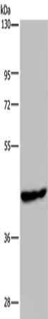 Gel: 8%SDS-PAGE, Lysate: 40 μg, Lane: Mouse skeletal muscle tissue, Primary antibody: PHKG1 Antibody(PHKG1 Antibody) at dilution 1/200, Secondary antibody: Goat anti rabbit IgG at 1/8000 dilution, Exposure time: 1 minuteRabbit anti-Human PHKG1 Polyclonal Antibody