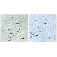 Immunohistochemistry analysis of paraffin-embedded human brain tissue using IGF1R (Ab-1346) antibody.Rabbit anti-Human IGF1R Polyclonal Antibody