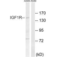Western blot analysis of extracts from A549 cells, using IGF1R (Ab-1346) antibody.Rabbit anti-Human IGF1R Polyclonal Antibody
