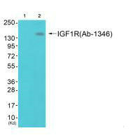 Western blot analysis of extracts from 293 cells (Lane 2), using IGF1R (Ab-1346) antiobdy. The lane on the left is treated with synthesized peptide.Rabbit anti-Human IGF1R Polyclonal Antibody