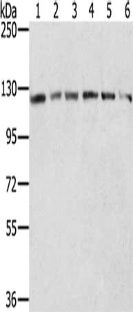 Gel: 6%SDS-PAGE, Lysate: 40 μg, Lane 1-6: Hela cells, Jurkat cells, 231 cells, A375 cells, A172 cells, Lovo cells, Primary antibody: RNF20 Antibody(RNF20 Antibody) at dilution 1/300, Secondary antibody: Goat anti rabbit IgG at 1/8000 dilution, Exposure time: 5 secondsRabbit anti-Human RNF20 Polyclonal Antibody