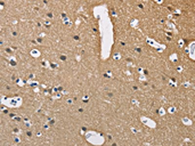 The image on the left is immunohistochemistry of paraffin-embedded Human brain  tissue using PPP3CA Antibody(PPP3CA Antibody) at dilution 1/40, on the right is treated with fusion protein. (Original magnification: ×200)Rabbit anti-Human PPP3CA Polyclonal Antibody
