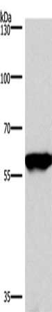Gel: 6%SDS-PAGE, Lysate: 40 μg, Lane: Mouse brain tissue, Primary antibody: PPP3CA Antibody(PPP3CA Antibody) at dilution 1/900, Secondary antibody: Goat anti rabbit IgG at 1/8000 dilution, Exposure time: 1 secondRabbit anti-Human PPP3CA Polyclonal Antibody