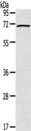 Gel: 8%SDS-PAGE,Lysate: 40 μg,,Primary antibody: LILRB2 Antibody(LILRB2 Antibody) at dilution 1/200 dilution,Secondary antibody: Goat anti rabbit IgG at 1/8000 dilution,Exposure time: 2 minutesRabbit anti-Human LILRB2 Polyclonal Antibody