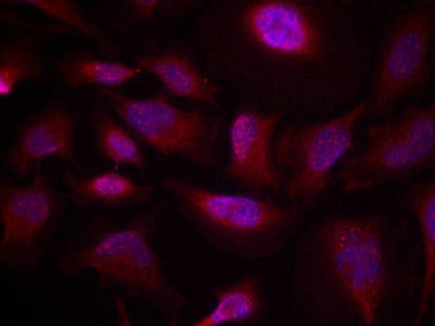 Immunofluorescence staining of methanol-fixed Hela cells using ATF2(Phospho-Thr73 or 55) Antibody.Rabbit anti-Human ATF2 Polyclonal Antibody
