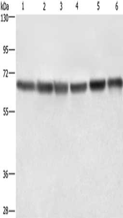 Gel: 6%SDS-PAGE, Lysate: 40 μg, Lane 1-6: Hela cells, HT29 cells, human fetal liver tissue, 231 cells, K562 cells, human bladder transitional cell carcinoma tissue, Primary antibody: LMNB1 Antibody(LMNB1 Antibody) at dilution 1/750, Secondary antibody: Goat anti rabbit IgG at 1/8000 dilution, Exposure time: 1 second