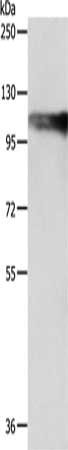 Gel: 8%SDS-PAGE, Lysate: 40 μg, Lane: SP20 cells, Primary antibody: AARS2 Antibody(AARS2 Antibody) at dilution 1/1200, Secondary antibody: Goat anti rabbit IgG at 1/8000 dilution, Exposure time: 15 secondsRabbit anti-Human AARS2 Polyclonal Antibody