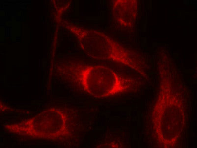 Immunofluorescence staining of methanol-fixed Hela cells using p53(Phospho-Ser46) Antibody.Rabbit anti-Human TP53 Polyclonal Antibody
