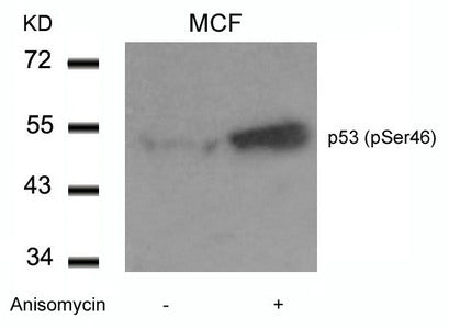 Western blot analysis of extracts from MCF cells untreated or treated with Anisomycin using p53(Phospho-Ser46) Antibody.Rabbit anti-Human TP53 Polyclonal Antibody