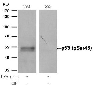 Western blot analysis of extracts from 293 cells, treated with UV+serum or calf intestinal phosphatase (CIP), using p53 (Phospho-Ser46) Antibody.Rabbit anti-Human TP53 Polyclonal Antibody