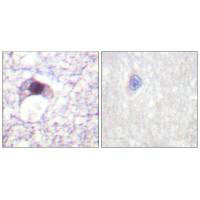 Immunohistochemical analysis of paraffin-embedded human brain tissue using E2F6 antibody.Rabbit anti-Human E2F6 Polyclonal Antibody