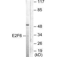 Western blot analysis of extracts from HepG2 cells, using E2F6 antibody.Rabbit anti-Human E2F6 Polyclonal Antibody