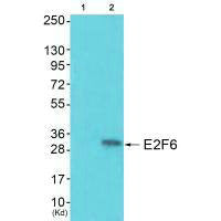 Western blot analysis of extracts from colo cells (Lane 2), using E2F6 antiobdy. The lane on the left is treated with synthesized peptide.Rabbit anti-Human E2F6 Polyclonal Antibody